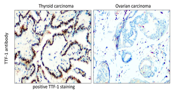 TTF-1 Rabbit Polyclonal Antibody
