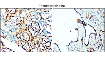 TTF-1 Rabbit Polyclonal Antibody