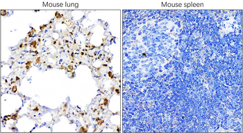 TTF-1 Rabbit Polyclonal Antibody