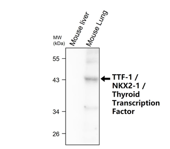TTF-1 Rabbit Polyclonal Antibody
