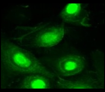 STAT5 Mouse Monoclonal Antibody