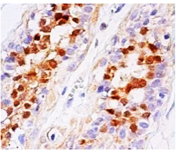 STAT5 Mouse Monoclonal Antibody