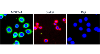 CD3 Intracellular domain Rabbit Polyclonal Antibody