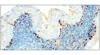 CD11b Rabbit Polyclonal Antibody