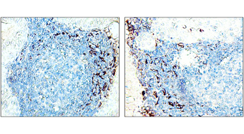 CD11b Rabbit Polyclonal Antibody