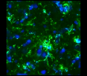 CD11b Rabbit Polyclonal Antibody