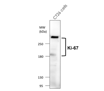 Ki67 Rabbit Monoclonal Antibody