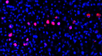 Ki67 Rabbit Monoclonal Antibody