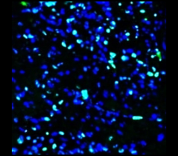 Ki67 Rabbit Monoclonal Antibody