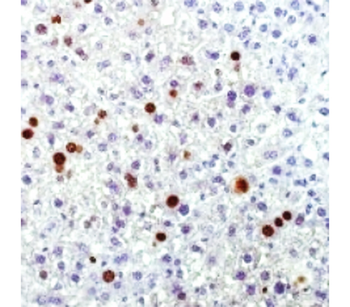 Ki67 Rabbit Monoclonal Antibody