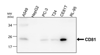 CD81 Rabbit Polyclonal Antibody