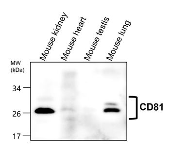 CD81 Rabbit Polyclonal Antibody