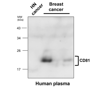 CD81 Rabbit Polyclonal Antibody