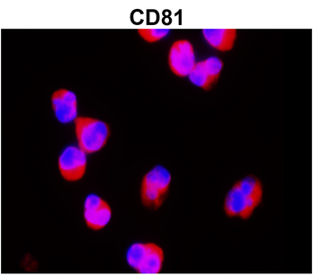 CD81 Rabbit Polyclonal Antibody