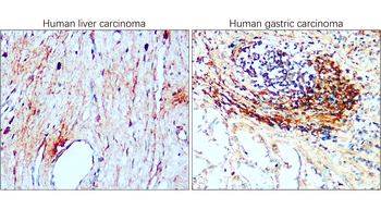 CD81 Rabbit Polyclonal Antibody