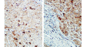 NLRP3 Rabbit Polyclonal Antibody