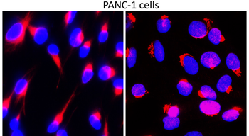 Fibronectin 1 Rabbit Polyclonal Antibody