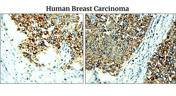 Fibronectin 1 Rabbit Polyclonal Antibody