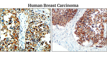 Fibronectin 1 Rabbit Polyclonal Antibody