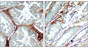 Fibronectin 1 Rabbit Polyclonal Antibody