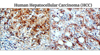 Fibronectin 1 Rabbit Polyclonal Antibody