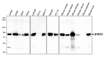 STAT3 Rabbit Polyclonal Antibody