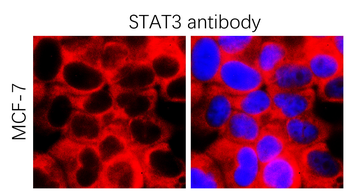 STAT3 Rabbit Polyclonal Antibody