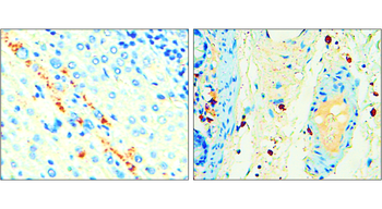 P-selectin | CD62P Rabbit Polyclonal Antibody