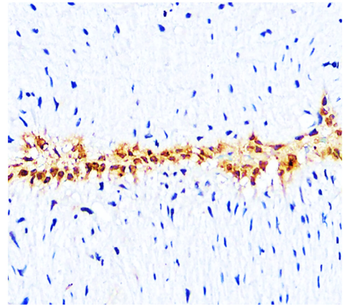 L-selectin | CD62L Rabbit Polyclonal Antibody