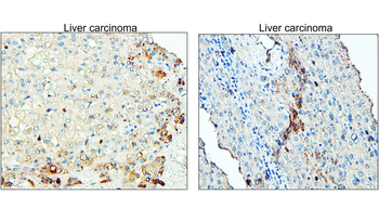 ST3GAL1 Rabbit Polyclonal Antibody