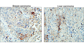 ST3GAL1 Rabbit Polyclonal Antibody