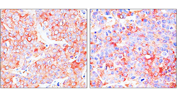ST3GAL1 Rabbit Polyclonal Antibody