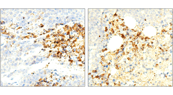 ST3GAL1 Rabbit Polyclonal Antibody