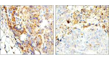 ST3GAL1 Rabbit Polyclonal Antibody