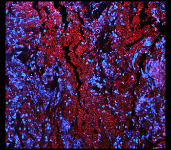 ST3GAL1 Rabbit Polyclonal Antibody