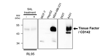 Tissue Factor Rabbit Polyclonal Antibody
