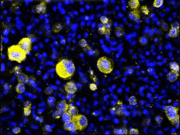 Tissue Factor Rabbit Polyclonal Antibody