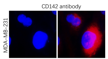 Tissue Factor Rabbit Polyclonal Antibody