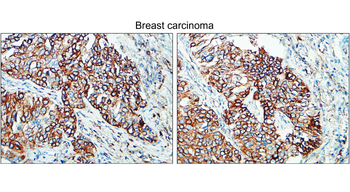 Tissue Factor Rabbit Polyclonal Antibody