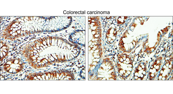 Tissue Factor Rabbit Polyclonal Antibody