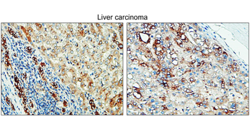 Tissue Factor Rabbit Polyclonal Antibody