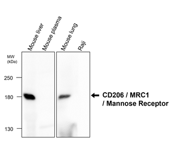 CD206 Rabbit Polyclonal Antibody