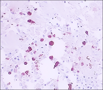 CD206 Rabbit Polyclonal Antibody