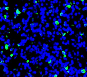 CD206 Rabbit Polyclonal Antibody