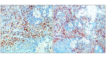 CD206 Rabbit Polyclonal Antibody