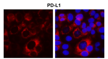 PD-L1 Rabbit Polyclonal Antibody