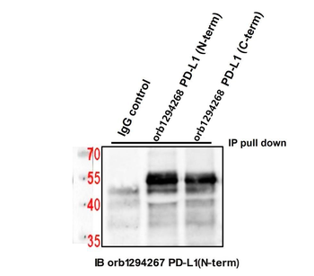 PD-L1 Rabbit Polyclonal Antibody