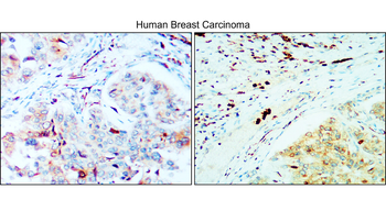 PD-L1 Rabbit Polyclonal Antibody