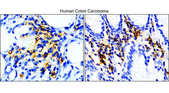 PD-L1 Rabbit Polyclonal Antibody