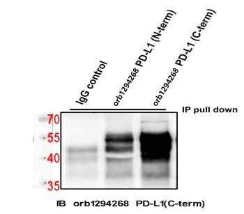 PD-L1 Rabbit Polyclonal Antibody